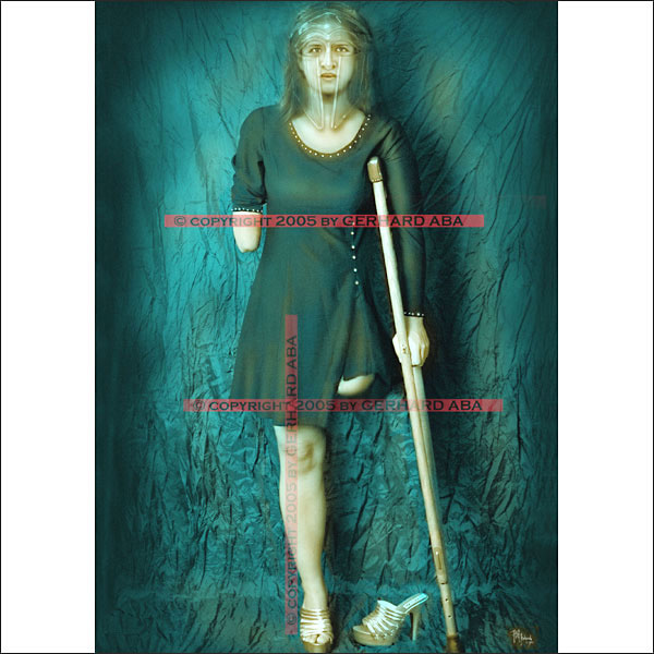 amputee005, © Gerhard Aba